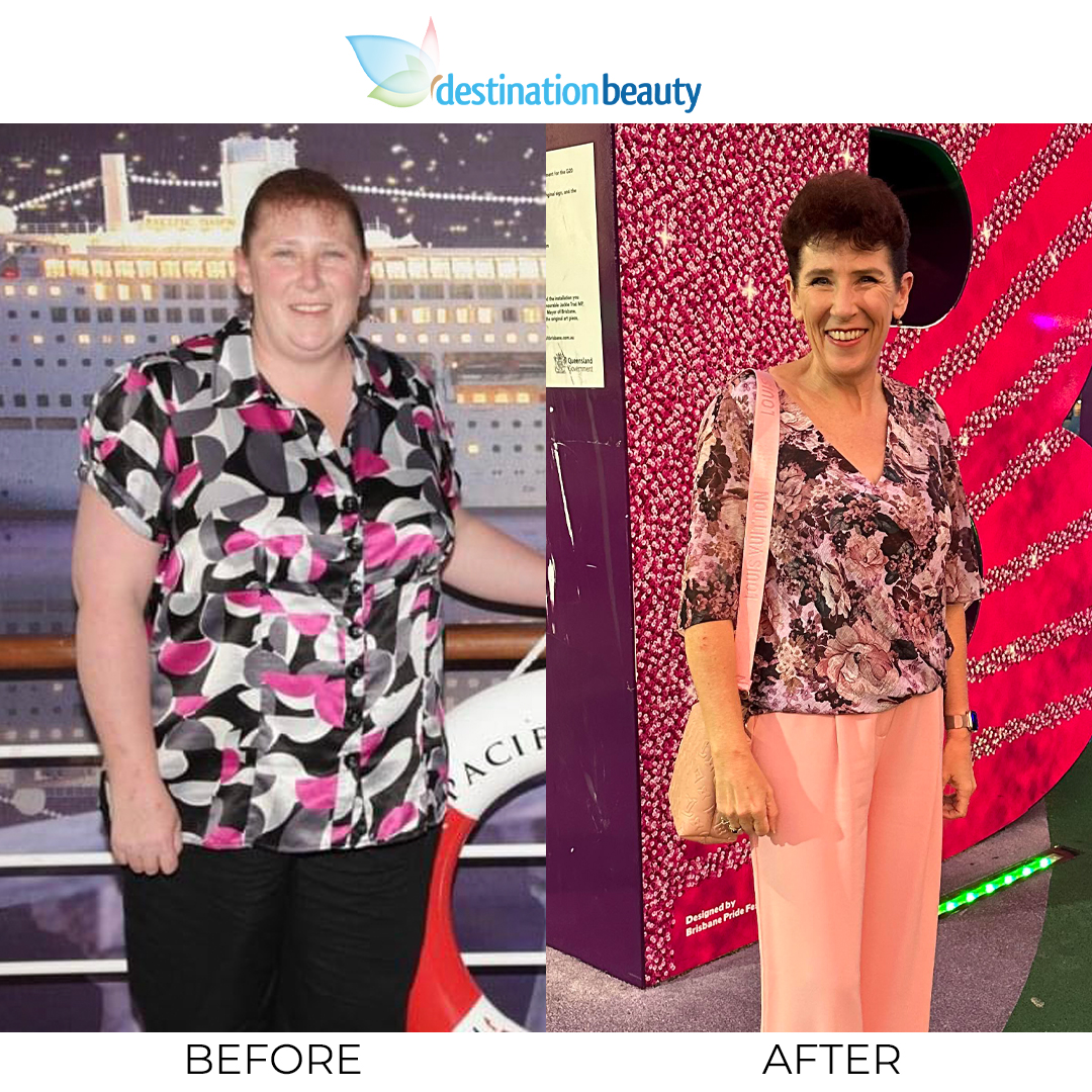 alison law weight loss Image 9
